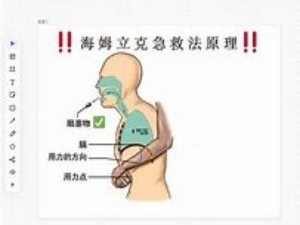 食物噎住时，海姆立克急救法为何有效？